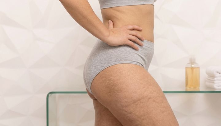 Região das pernas com alteração visível na textura da pele